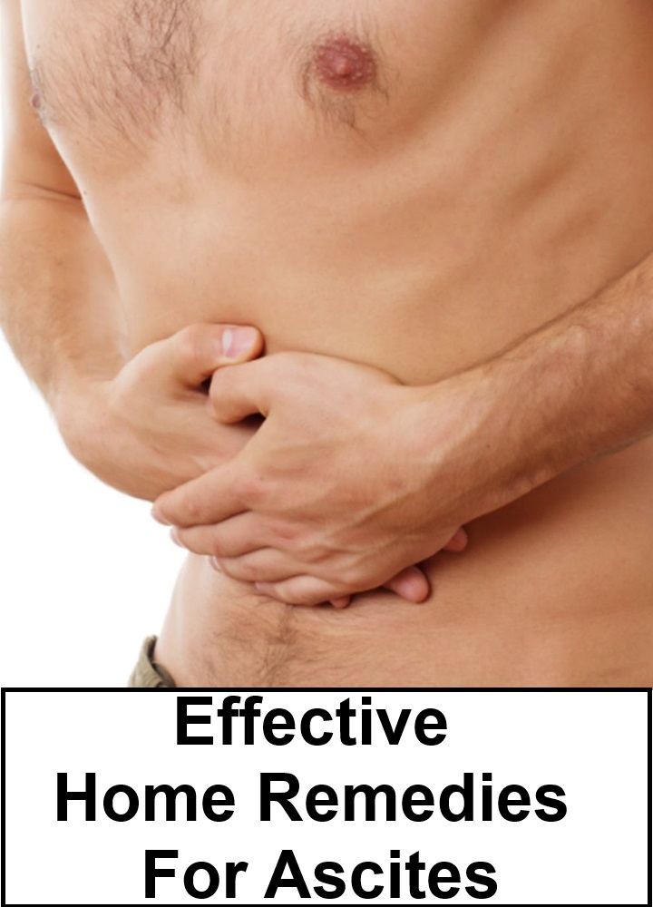 Effective Home Remedies For Ascites